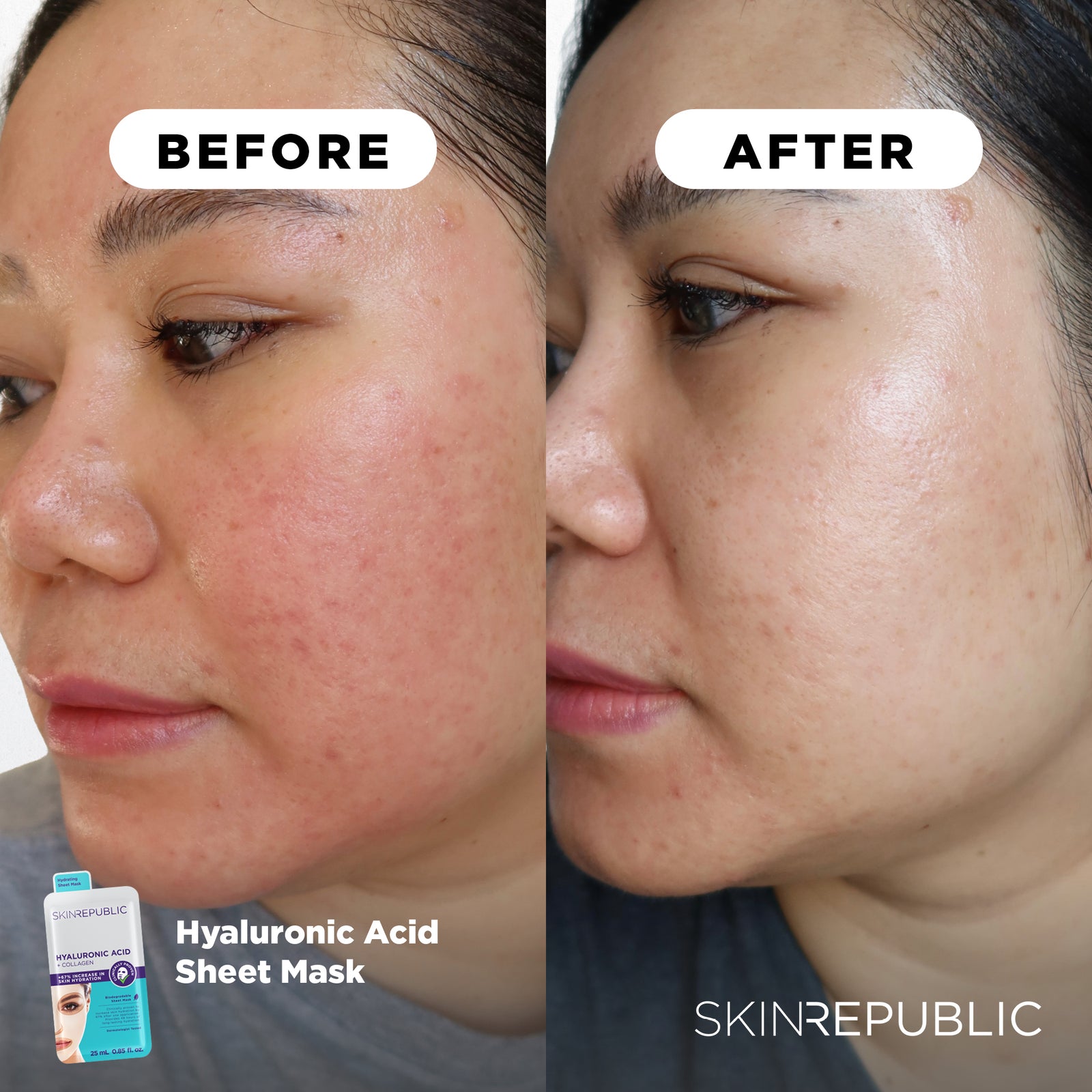 Hyaluronic Acid + Collagen Face Mask