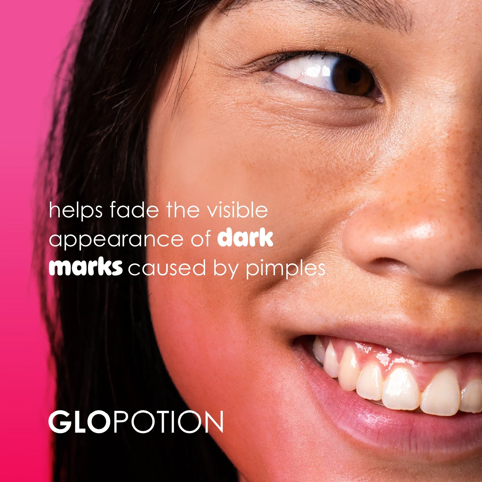 GloPotion salicylic acid pimple patches (36 patches)