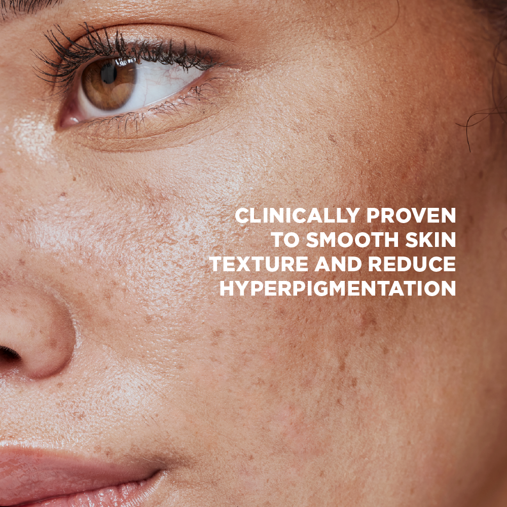 Microdart Serum Ampoule + Spicule