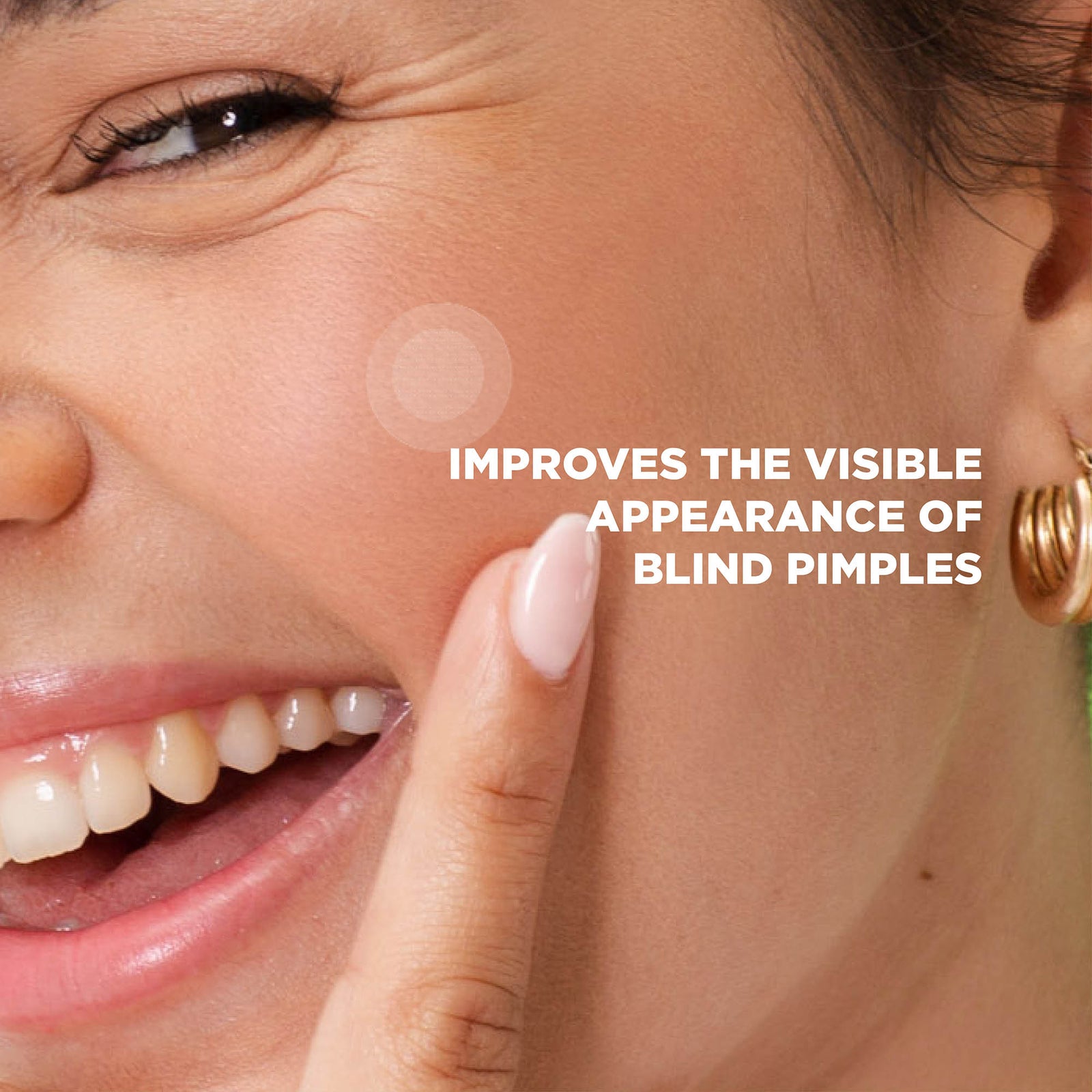 Microdart Spot Clear Patches (9 Patches)