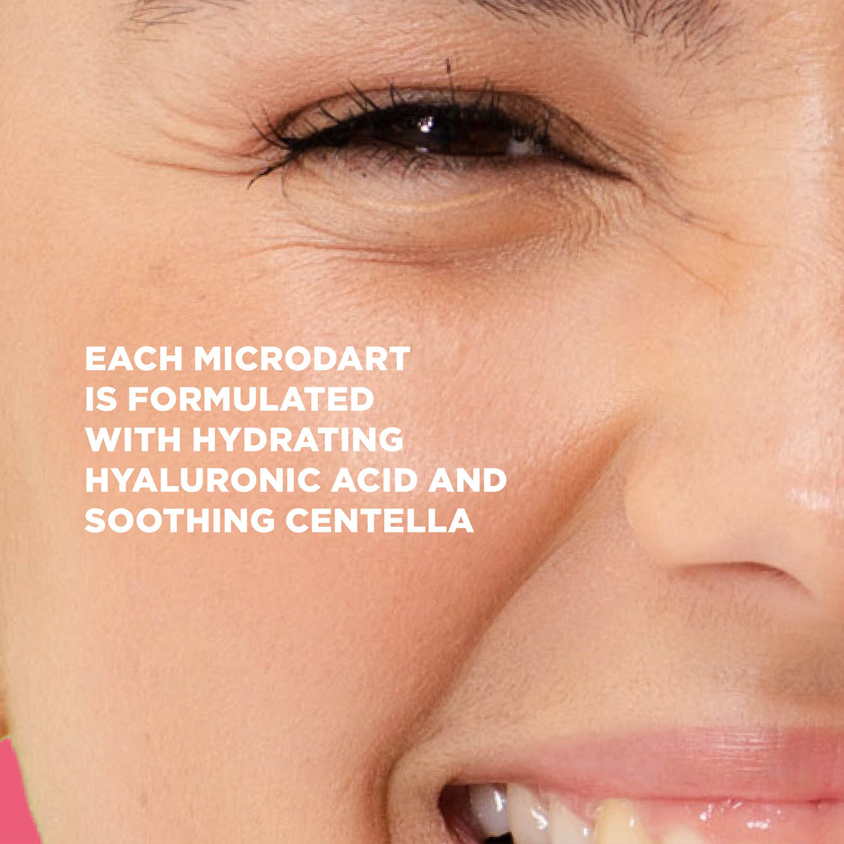 Microdart Spot Clear Patches (9 Patches)