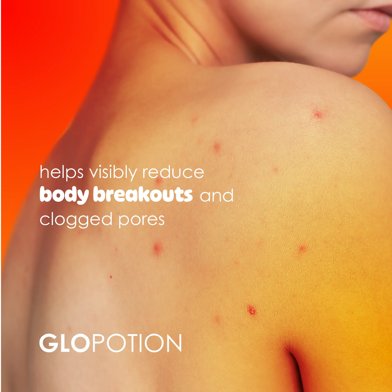 GloPotion Glycolic Acid 5% + Niacinamide 5% + Zinc Body Spray