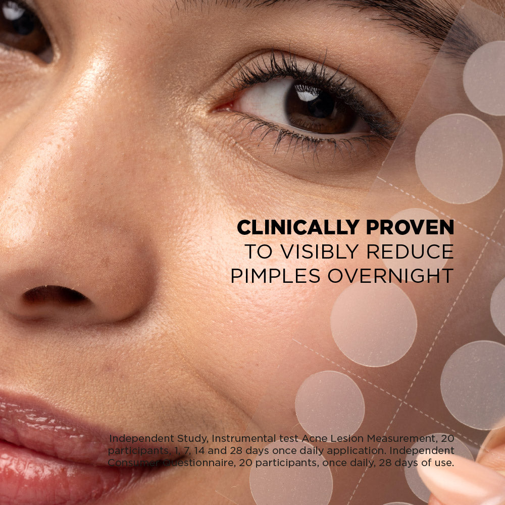 Spot Clear Intense Patch + Niacinamide (24 Patches)