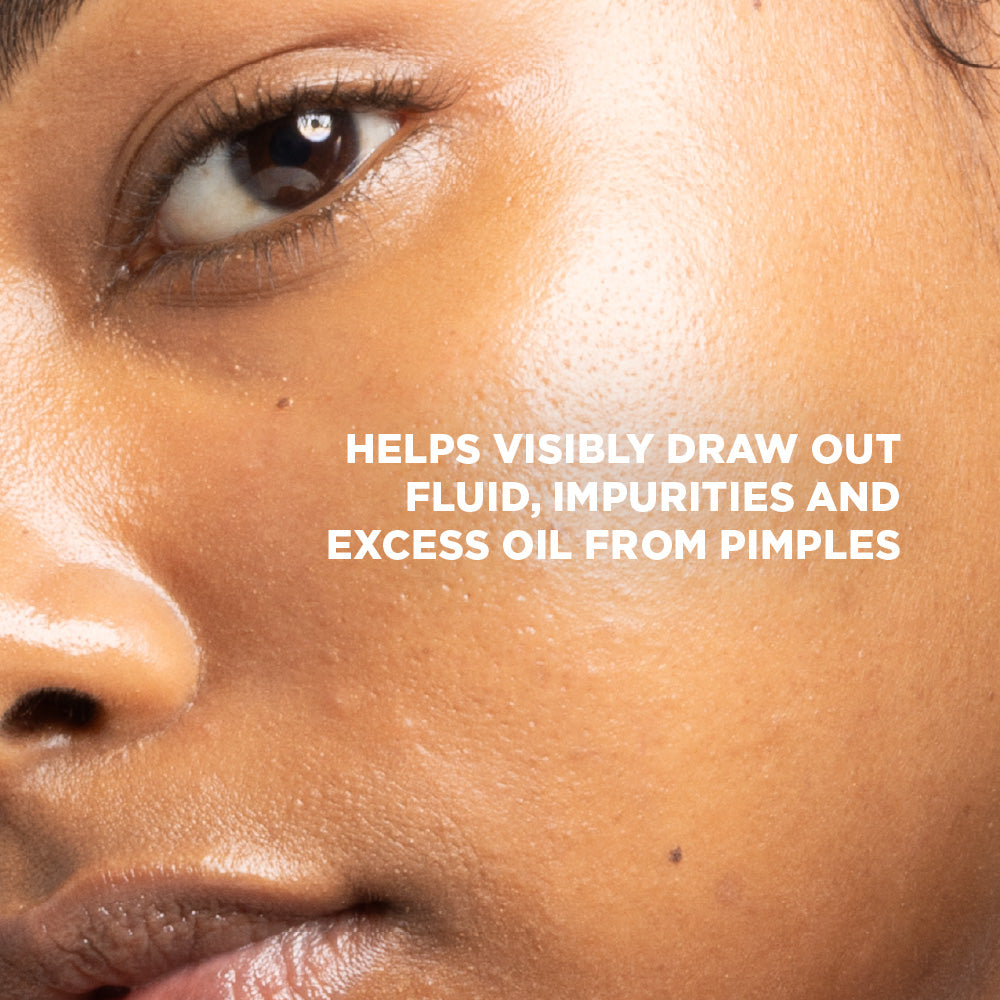 XL Spot Clear Patch (10 Patches)